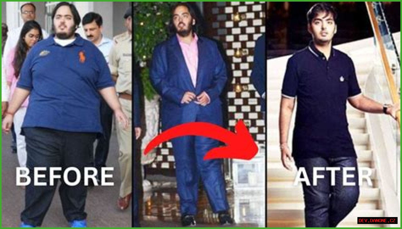 Anant Ambani's Journey: Battling A Rare Disease With Courage