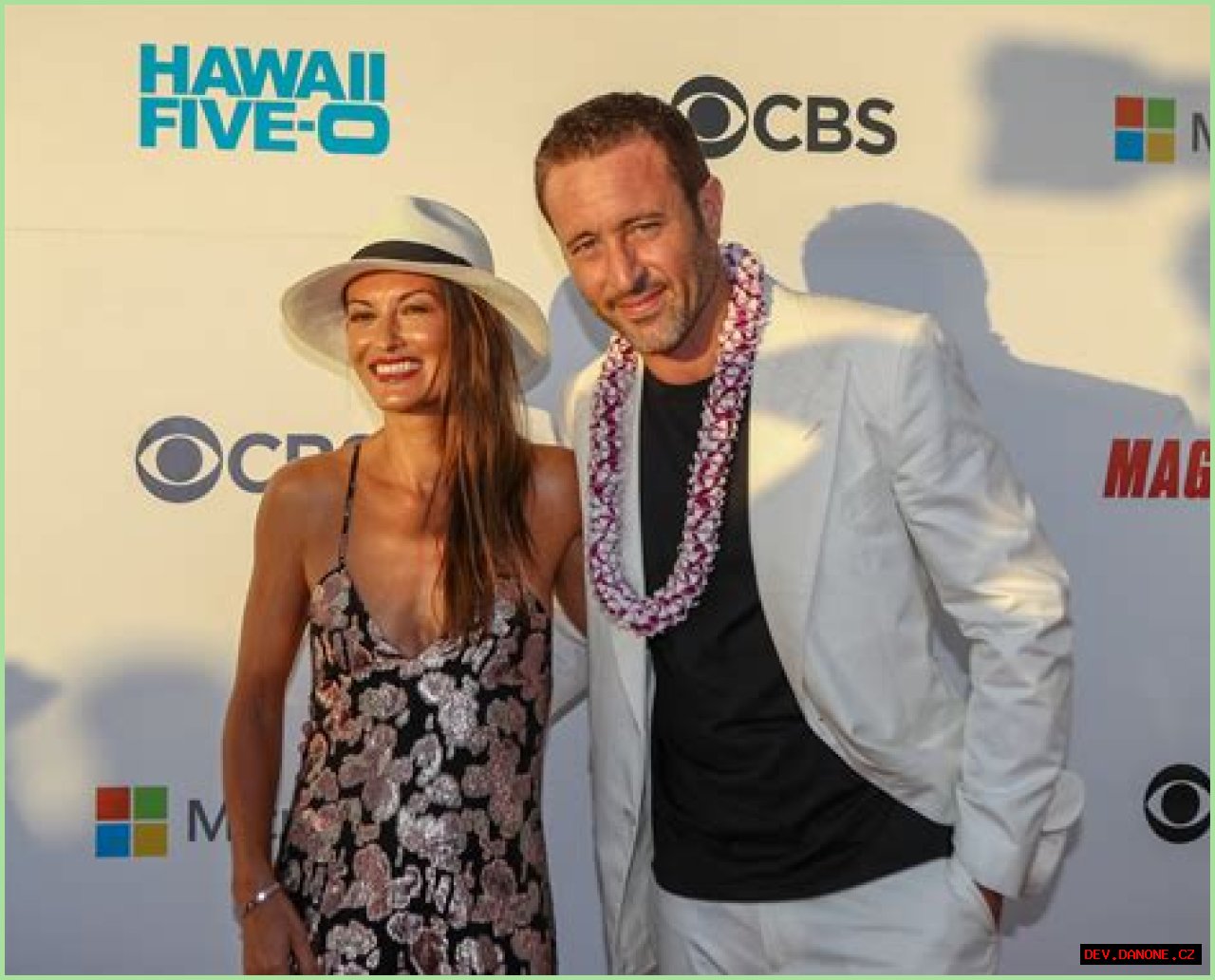 Exploring Alex O'Loughlin's Maison: A Deep Dive Into His Life And Home