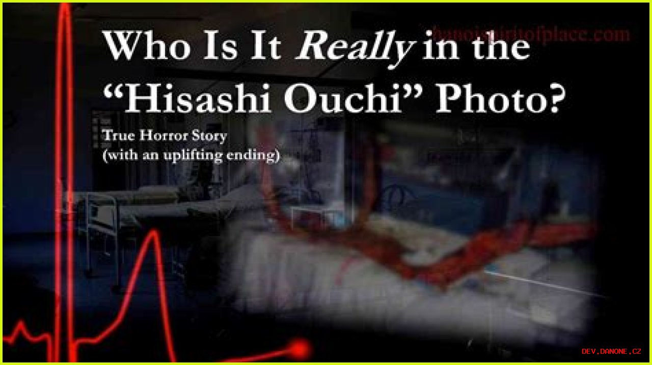 Unraveling The Mystery Of Hisashi Ouchi's Corpse: A Journey Through Tragedy And Science