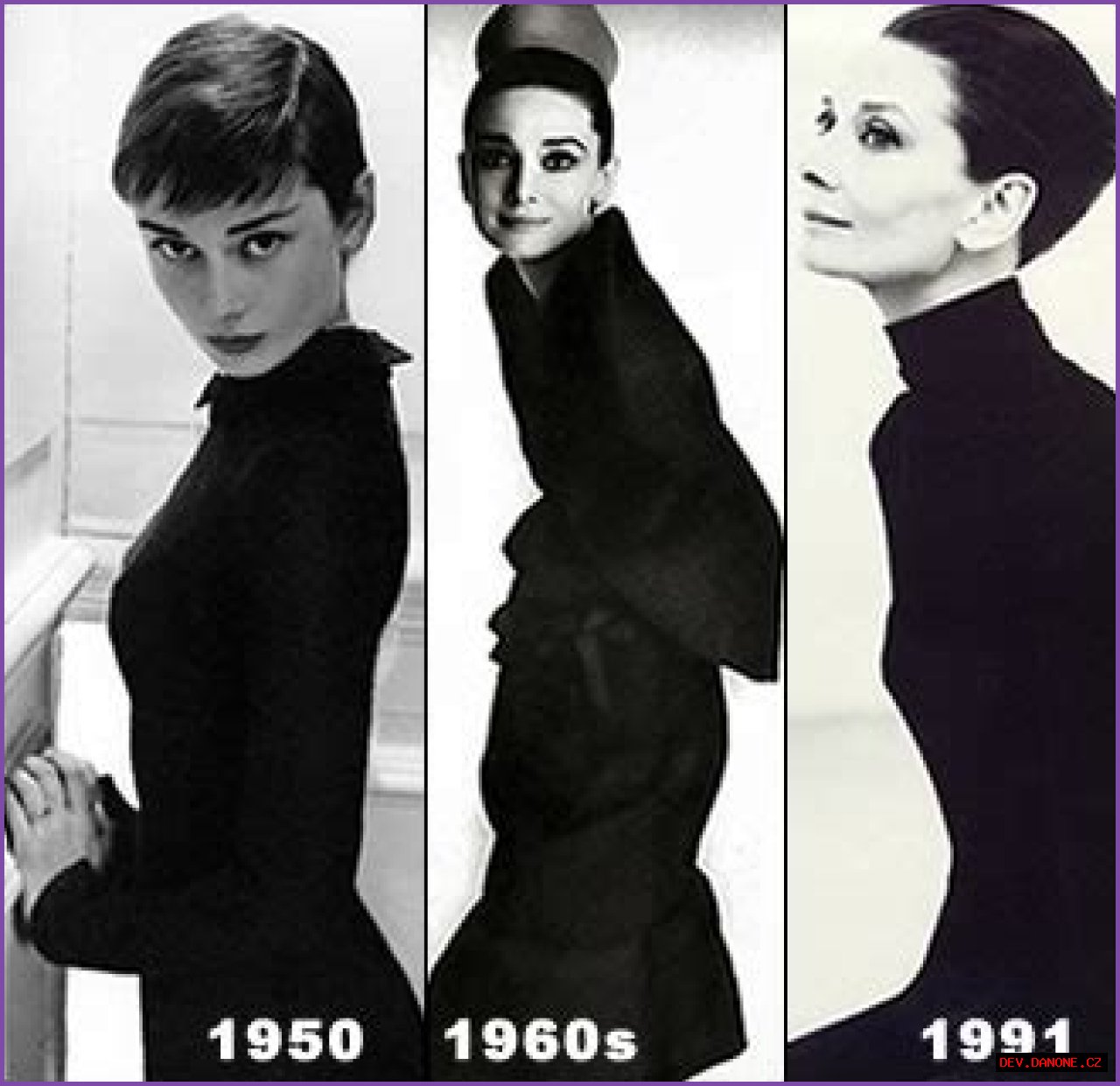 Unveiling The Truth: Did Audrey Hepburn Have Plastic Surgery?